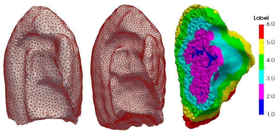 Lung Model