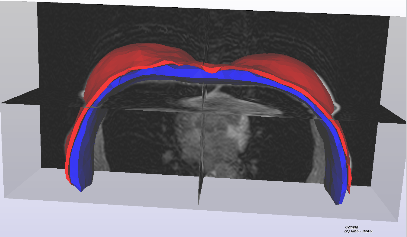 Biomeca image 3