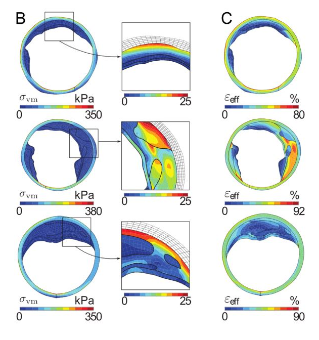 bioméca image 4