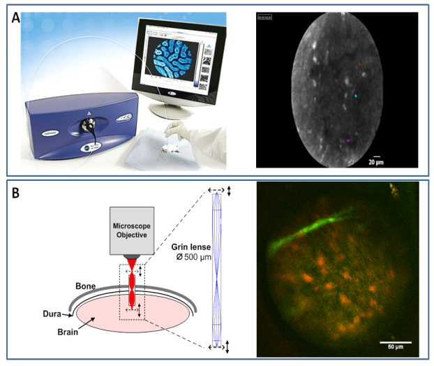 microendoscopie