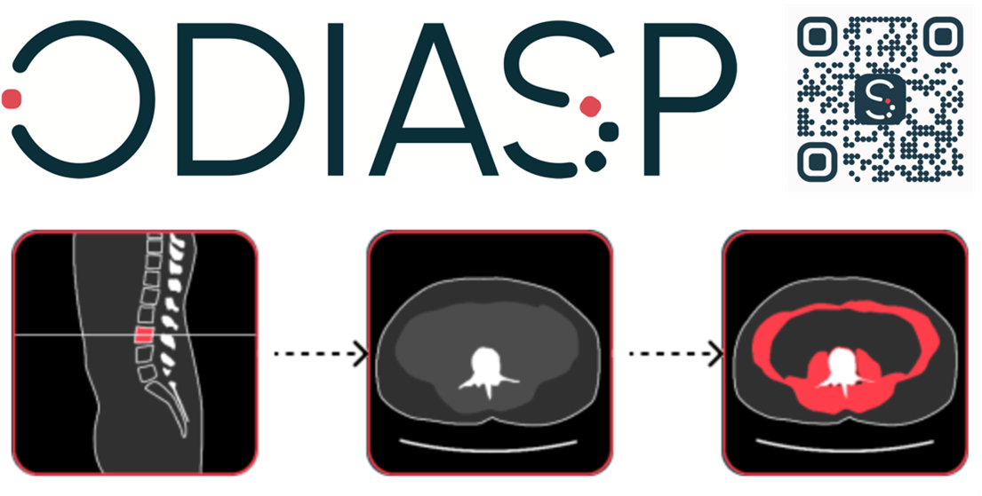 odiasp
